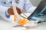 What Are the Early Signs of Ankle Arthritis in Charleston, SC?