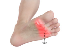 Forefoot Pain